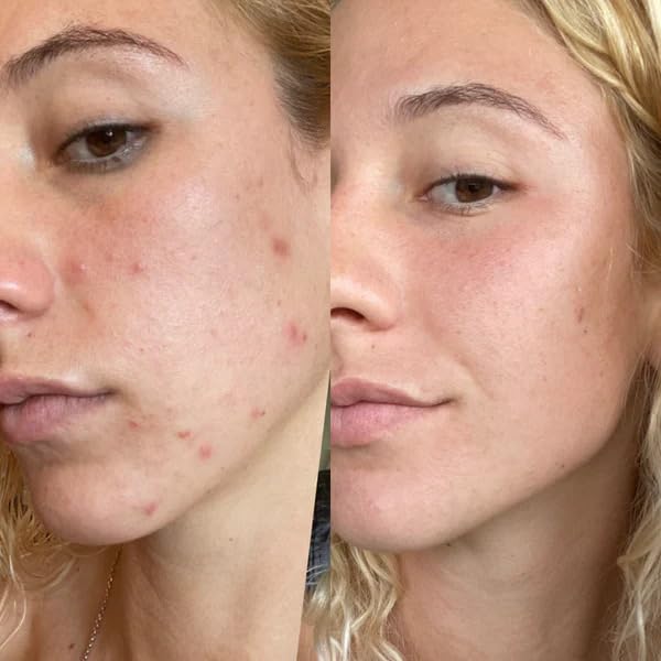 Gin Amber Beauty - Retinol 2.5% Serum - Anti-aging | Brighthening, Plant Based Retinol Serum (1 fl
