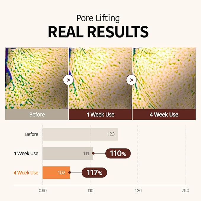 GOODAL Retinol + Black Carrot Gel Sheet Mask ??Intensive Hydration & Pore-Lifting, Cooling