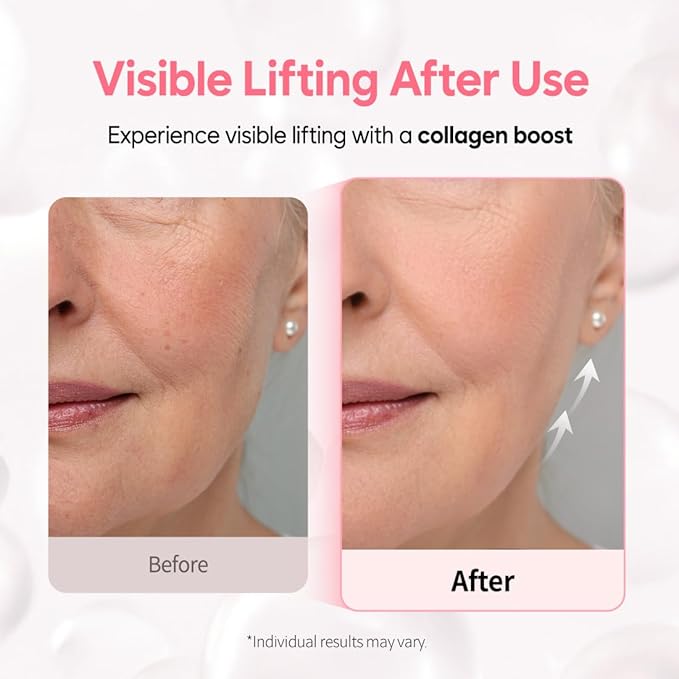 Overnight Collagen Lifting Gel Mask 5 pcs, Korean Face Lifting Deep Hydrogel Mask for Glass Skin