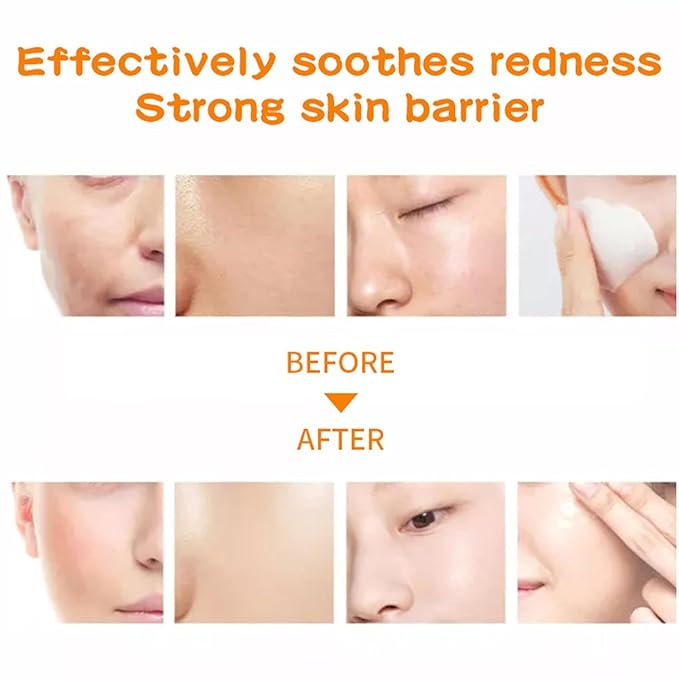 18 Pack Collagen Face Masks Skincare Bulk,Hydrating Spa Face Mask Beauty for Sensitive Skin,Sheet