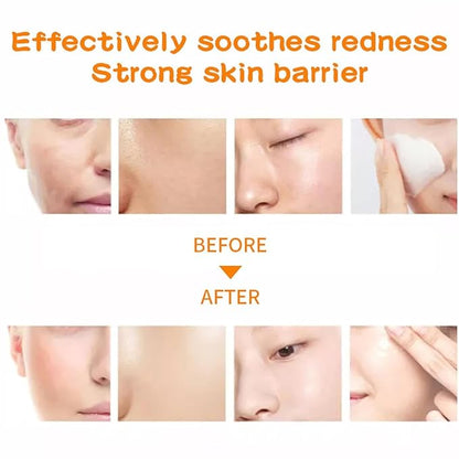 18 Pack Collagen Face Masks Skincare Bulk,Hydrating Spa Face Mask Beauty for Sensitive Skin,Sheet