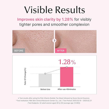 SU:M Micro-Active Pink Vitamin Bubbletox Mask Pack (0.13 fl oz x 14ea) - Korean Skincare ??Deep
