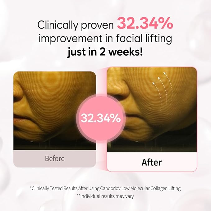 Overnight Collagen Lifting Gel Mask 5 pcs, Korean Face Lifting Deep Hydrogel Mask for Glass Skin