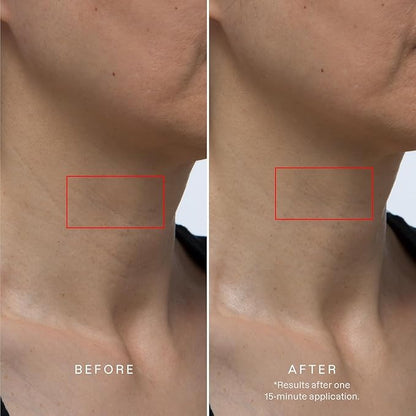 Karuna Skin - COLLAGEN Decollete & Neck Hydrogel Mask, 2-Piece Deeply Moisturizing Wrinkle Patches
