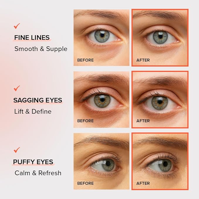 KLAVUU Real Vegan Collagen Eye Patches (60 Patches) - Korean Overnight Under Eye Mask for Puffy