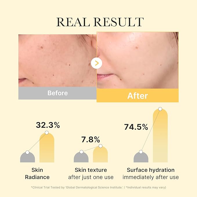medicube Kojic Acid Turmeric Brightening Gold Jelly Gel Mask | Overnight Face Mask for Glass Glow