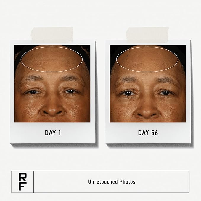 Rodan + Fields Redefine Daily Face Clay Cleanser (125 mL) | Advanced Skin Care | Exfoliating Face