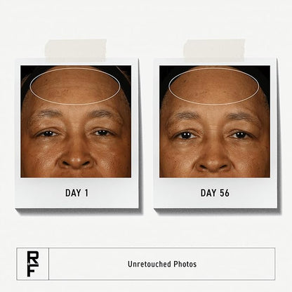 Rodan + Fields Redefine Daily Face Clay Cleanser (125 mL) | Advanced Skin Care | Exfoliating Face