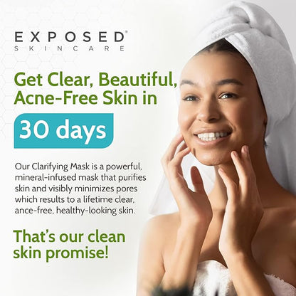Exposed Skin Care Activated Charcoal Face Mask to Purify Skin, Regulate Oil Production and Visibly