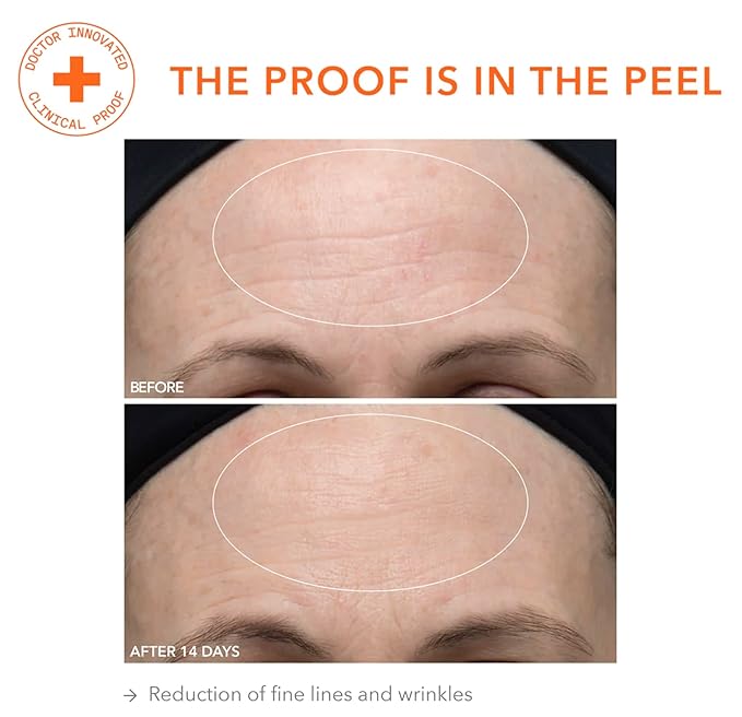 Dr. Dennis Gross Alpha Beta Ultra Gentle Daily Peel: for Dehydrated or Sensitive Skin, Uneven Tone