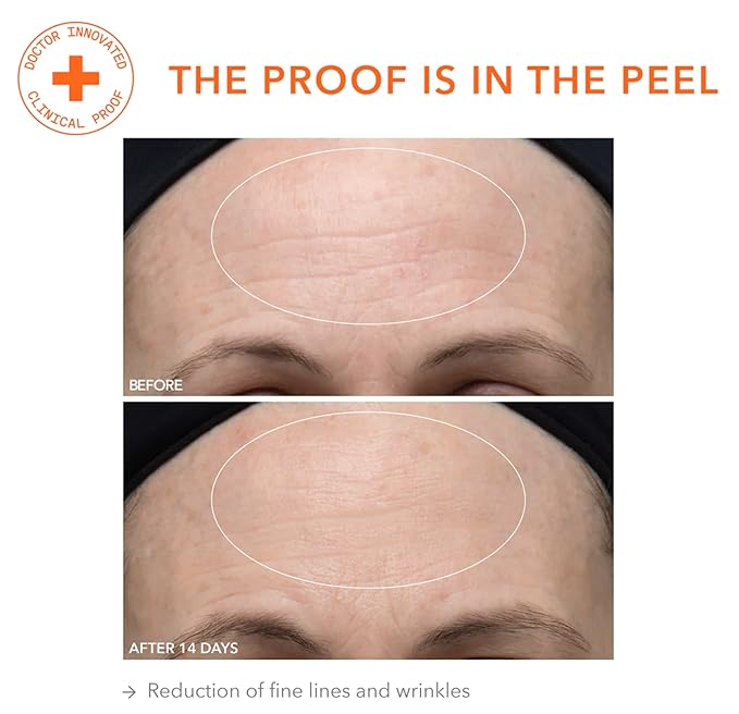 Dr. Dennis Gross Alpha Beta Ultra Gentle Daily Peel: for Dehydrated or Sensitive Skin, Uneven Tone