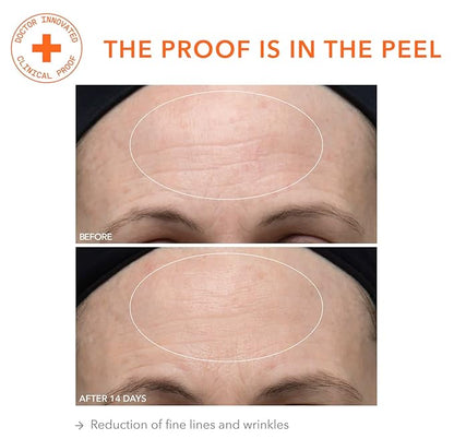 Dr. Dennis Gross Alpha Beta Ultra Gentle Daily Peel: for Dehydrated or Sensitive Skin, Uneven Tone