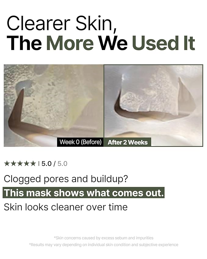 Trouble Patch Mask | Korean Face Mask ??Hydrating & Acne Face Mask for Blemish-Prone Skin, Calming