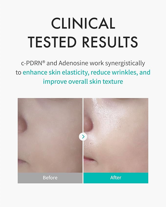 REJURAN® Turnover Mask, c-PDRN® (5ea) ??Original Salmon DNA for Firming, Hydration, Repairing &