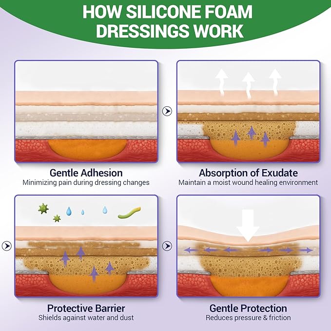 Silicone Foam Dressing 4" x 4" with Border, High Absorbency Wound Bandage, Gentle Adhesion, Soft