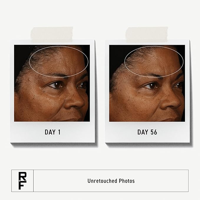 Rodan + Fields Redefine Daily Face Clay Cleanser (125 mL) | Advanced Skin Care | Exfoliating Face