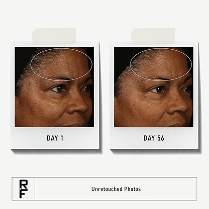 Rodan + Fields Redefine Daily Face Clay Cleanser (125 mL) | Advanced Skin Care | Exfoliating Face