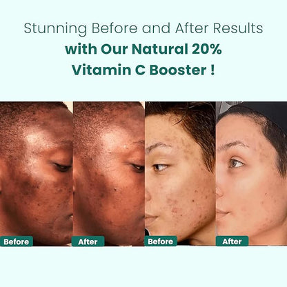 Gin Amber Beauty - Natural 20% Vitamin C Booster - Brightening