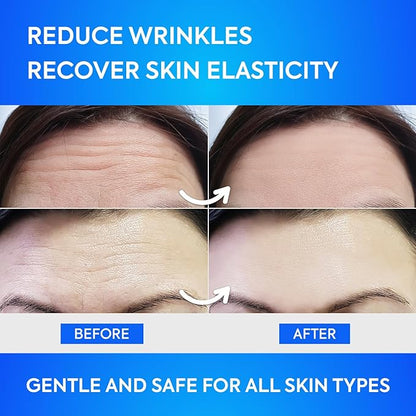 Forehead Wrinkle Patches 12Pcs with Aloe, Collagen, Vitamin E, Anti Wrinkle Patches, Forehead