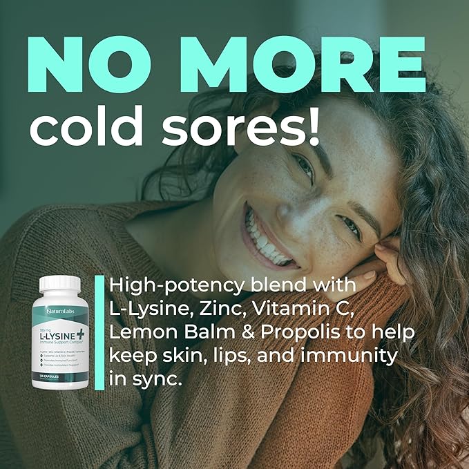 L-Lysine + Cold Sore Immune Support Supplement – with Vitamin C, Zinc, Bee Propolis, Lemon Balm &