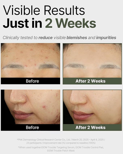 Trouble Patch Mask | Korean Face Mask ??Hydrating & Acne Face Mask for Blemish-Prone Skin, Calming