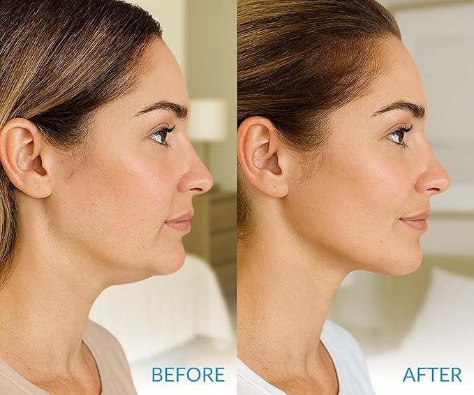 Stylia MaxiLift V-Line Lifting Collagen Face Mask – Enhanced Double Chin Reducer – Jawline Shaper