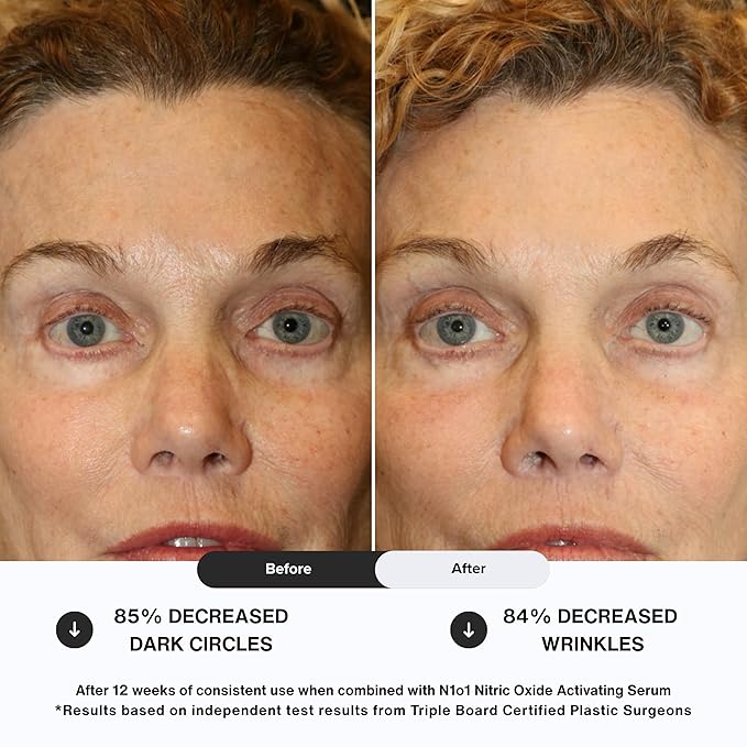 Age-Defiance Eye Cream - Day & Night Moisturizer with Nitric Oxide, Hyaluronic Acid, Complex