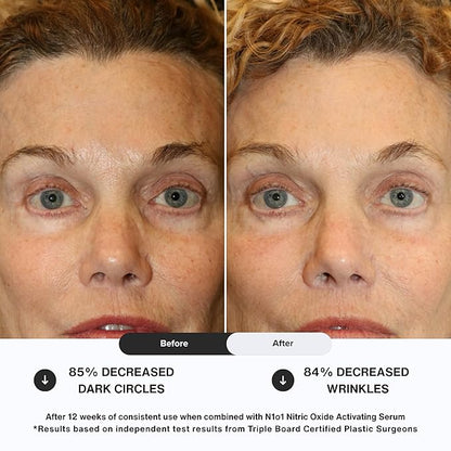 Age-Defiance Eye Cream - Day & Night Moisturizer with Nitric Oxide, Hyaluronic Acid, Complex