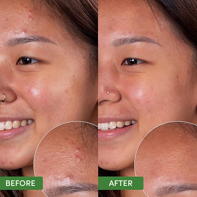 Sand & Sky Oil Control Gentle Face Cleanser with AHA & BHA - pH-Balanced Blemish Cleanser, Reduces
