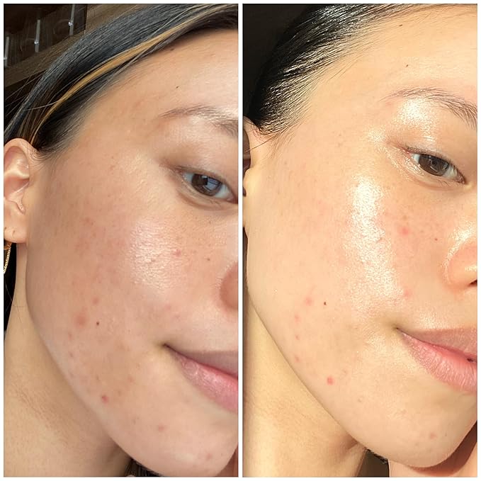 Sand & Sky Tasmanian Spring Water Intense Hydration Face Mask with Pentavitin & Hyaluronic Acid
