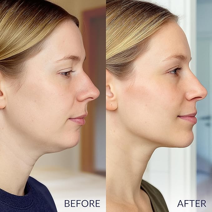 Stylia V Line Lifting Collagen Face Mask - Double Chin Strap for Women - Jawline Shaper Face Lift