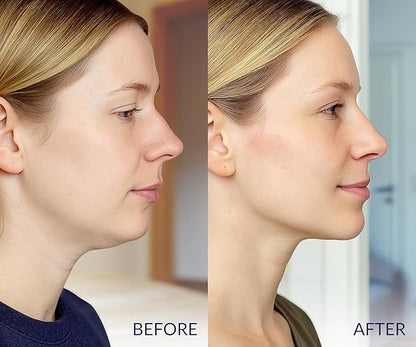 STYLIA V Line Lifting Collagen Face Mask - Double Chin Strap for Women - Jawline Shaper Face Lift