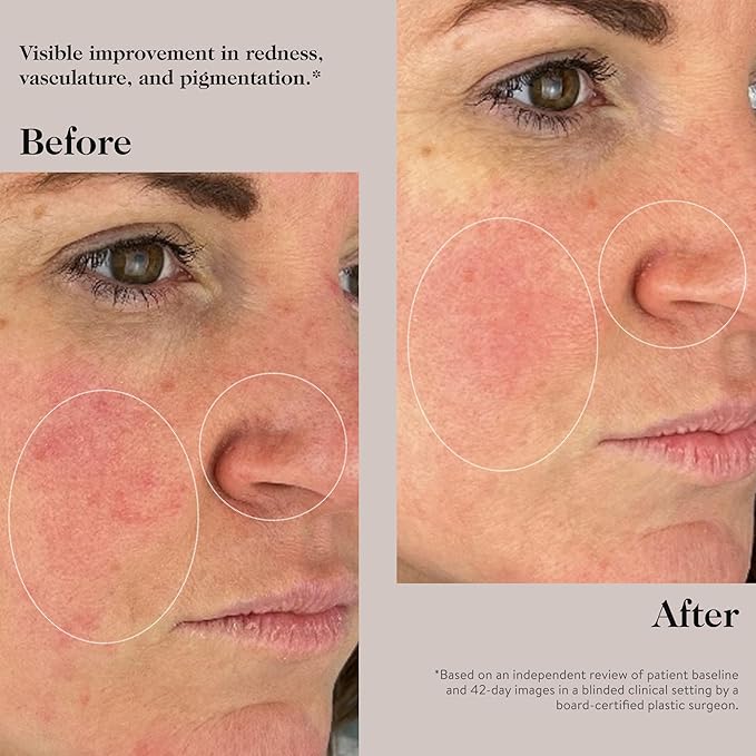 goop Beauty Peptide Serum |Reduces Fine Lines, Wrinkles, & Dark Spots | Peptides, Ceramides, &